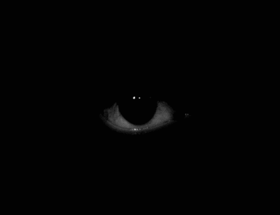 eye